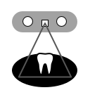 IScan3D Dental