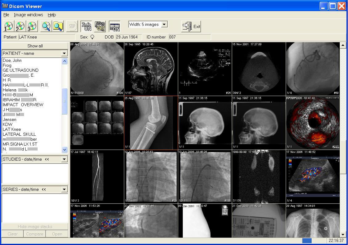 Sante DICOM Viewer Pro 12.2.5 instal the new version for mac