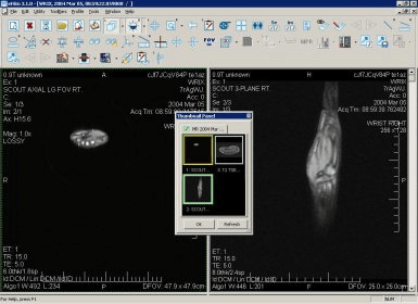 efilm lite move to next image