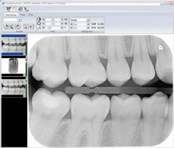 In vivo dental viewer windows 10 не запускается