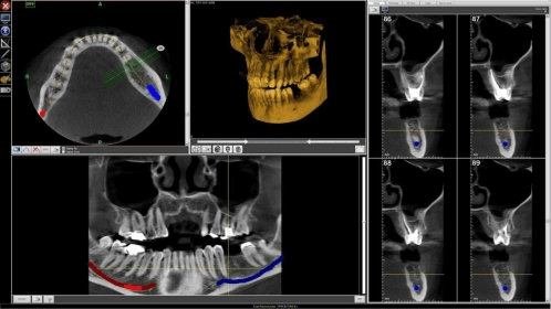 Fona OrisWin DG Suite Download - Powerful imaging program