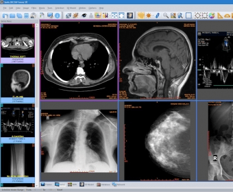 Sante DICOM Viewer Pro 12.2.5 download the new for ios
