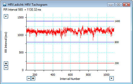 ADInstruments HRV 1.4 : Main window