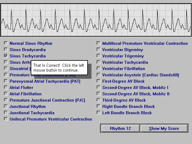 Electrocardiography Part Ii Download Educational Software For Electrocardiography Technicians And Ecg Ekg Students