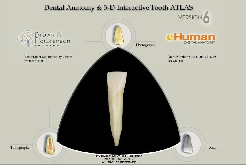 3d tooth atlas free download