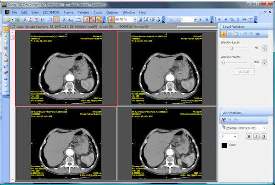 cdr dicom export images to disk drive