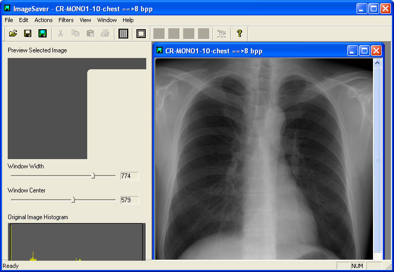 free download dicom image viewer for mac 10.10.5