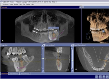 Dentsply Sirona Sidexis 4.2 Download - Sidexis4.exe