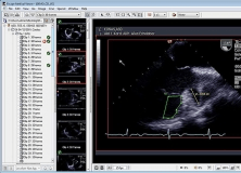 free philips dicom viewer for windows 10