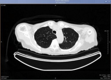 Mckesson Radiology Viewer Download