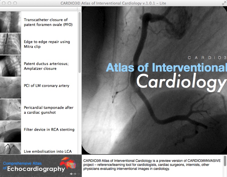 CARDIO3® Atlas of Interventional Cardiology 1.0 : Main Window