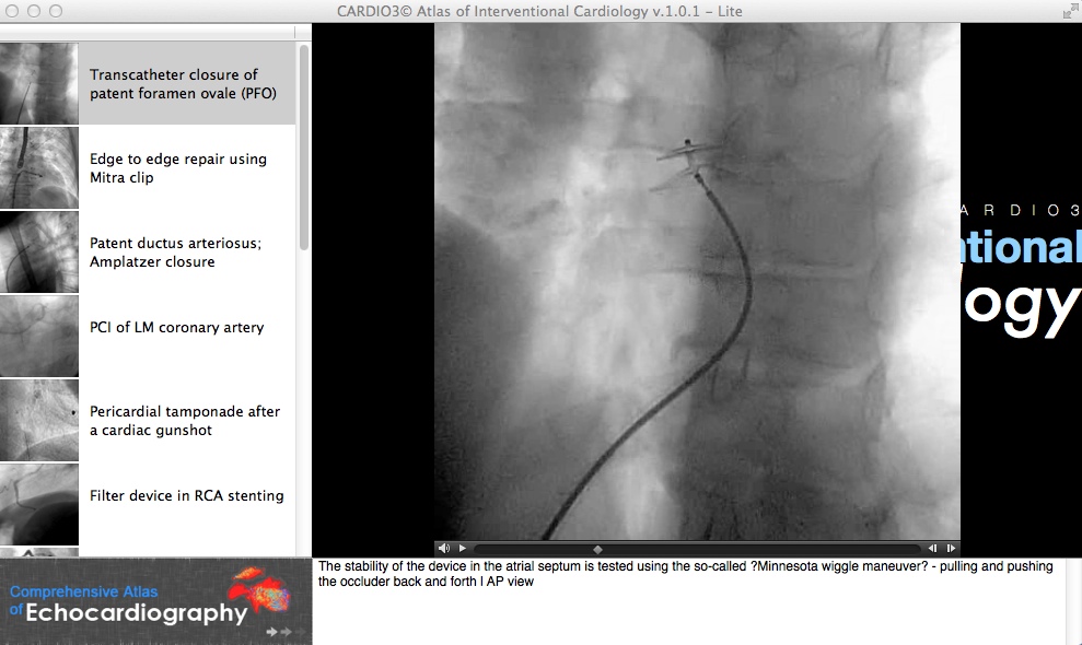 CARDIO3® Atlas of Interventional Cardiology 1.0 : Checking Video Tutorial