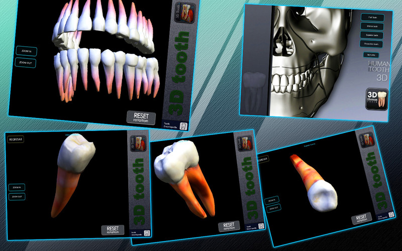 3D Tooth - St 1.0 : 3D Tooth - St screenshot