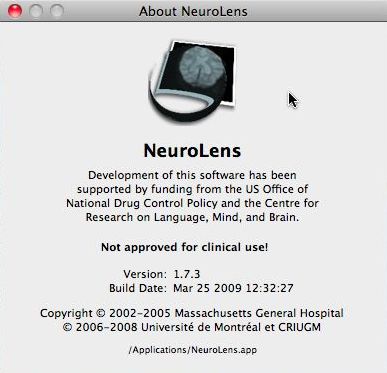 NeuroLens 1.7 : Main window