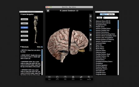 Brain Pro screenshot