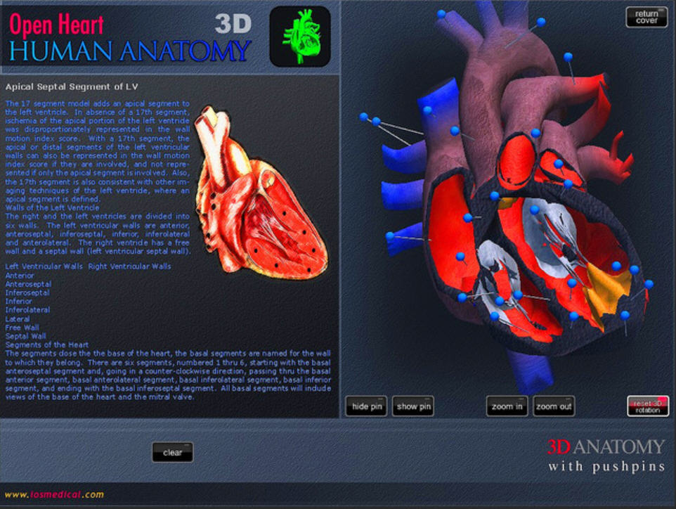Open Heart 3D 1.0 : Main Window