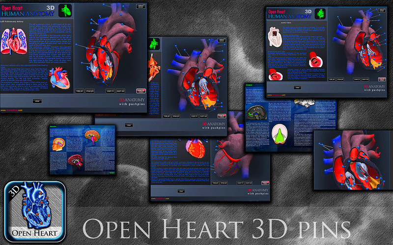 Open Heart 3D 1.0 : Open Heart 3D screenshot