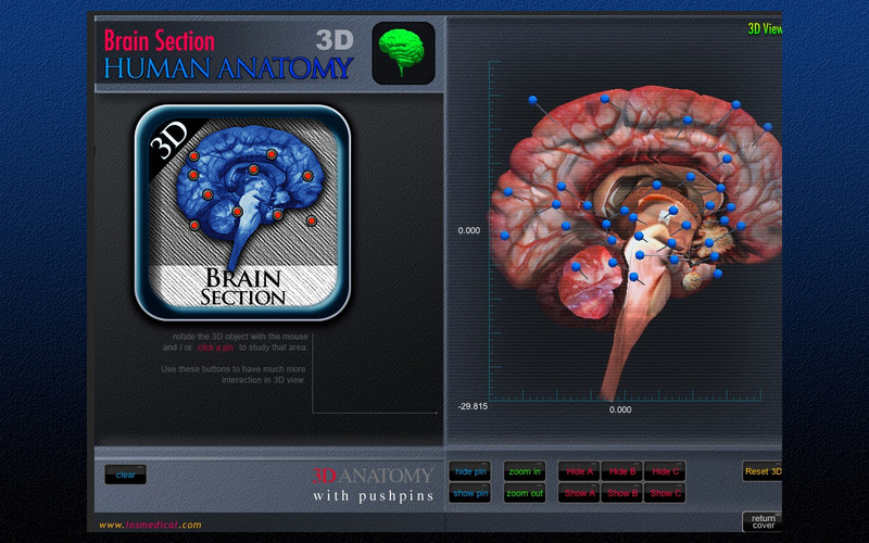 Brain Section 3D 1.0 : Main window