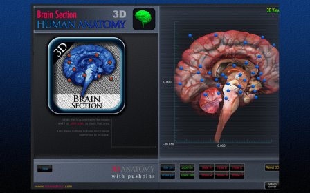 Brain Section 3D screenshot