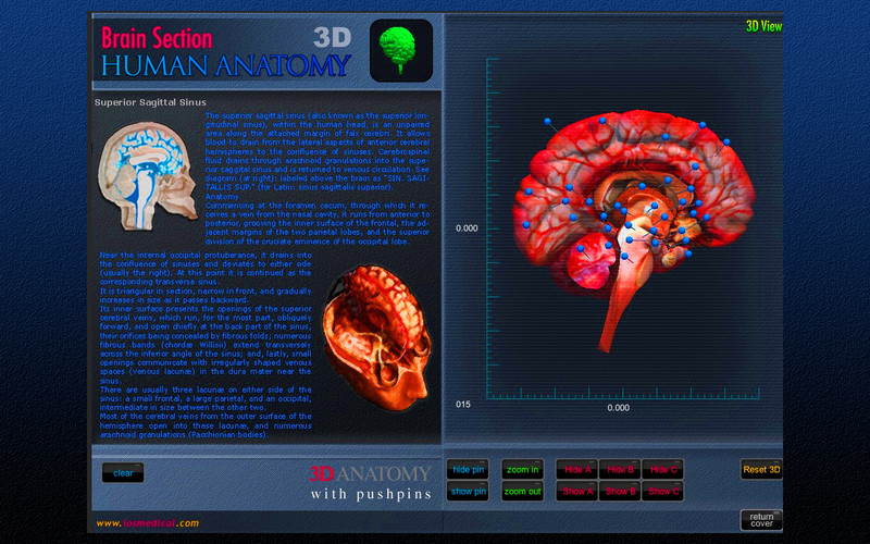 Brain Section 3D 1.0 : Brain Section 3D screenshot