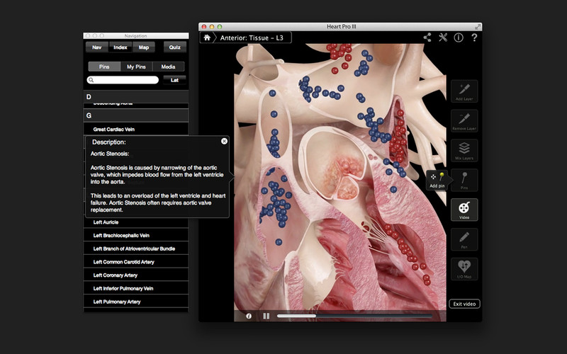 HeartPro 3.0 : Heart Pro III screenshot