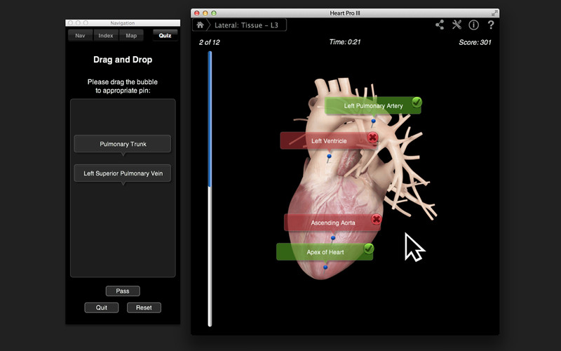 HeartPro 3.0 : Heart Pro III screenshot