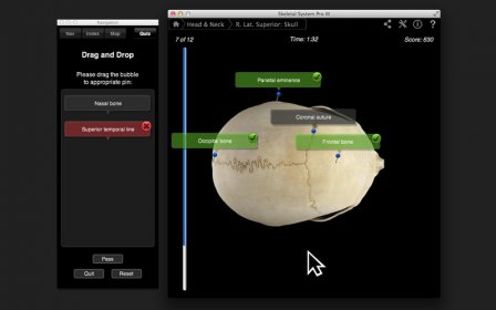 Skeletal System Pro III screenshot