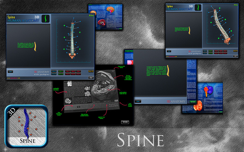 3D Spine St 1.0 : 3D Spine St screenshot