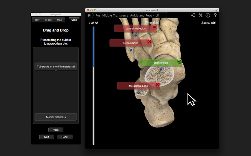 Ankle & Foot Pro III 3.0 : Ankle & Foot Pro III screenshot