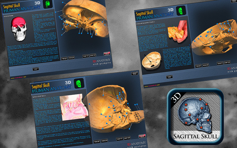 Sagittal Skull 3D 1.0 : Sagittal Skull 3D screenshot