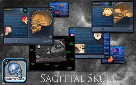 Sagittal Skull 3D screenshot