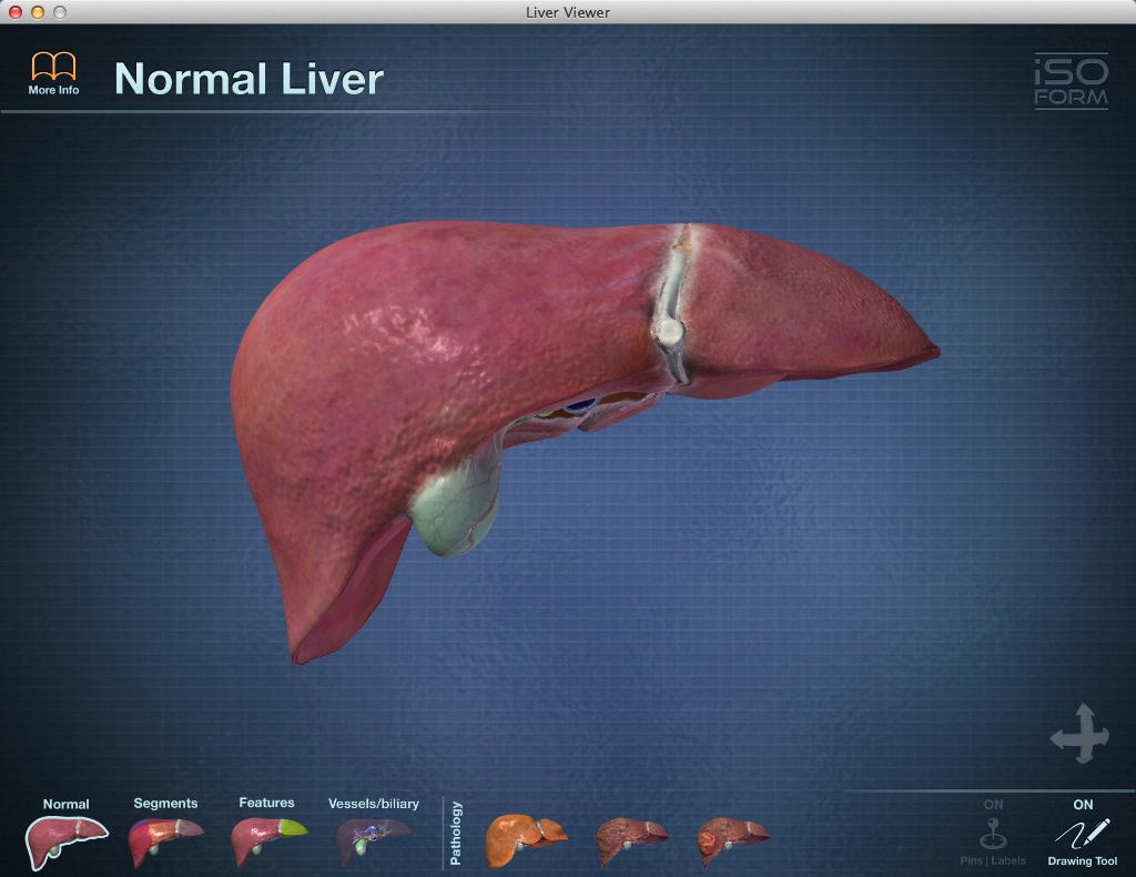 Liver Viewer 1.0 : Main Window