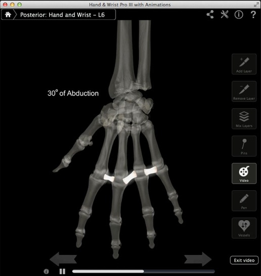 Hand & Wrist Pro III 3.2 : Main window