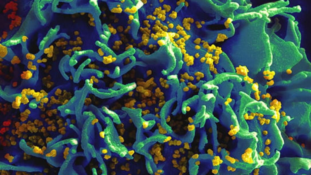 HIV 3D study 1.0 : Cell Model Window