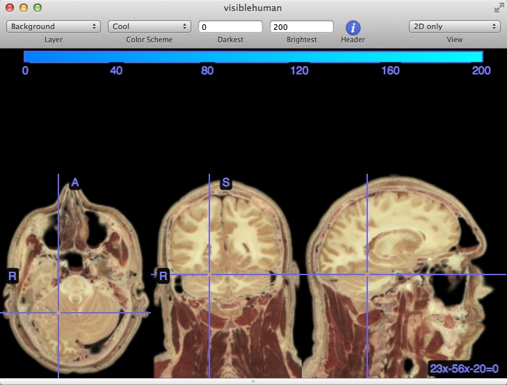 MRIcro 1.8 : 2D View